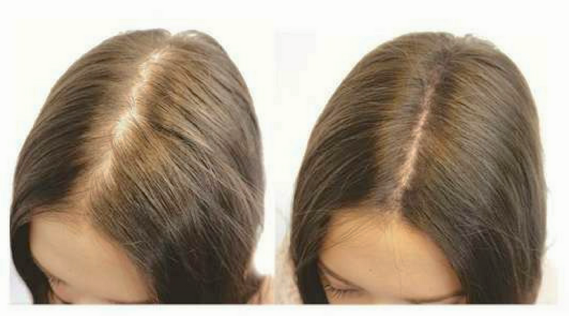 cheveux_long_trichopigmentation.ch