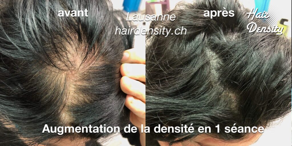 trichopigmentation femme hairdensity.ch
